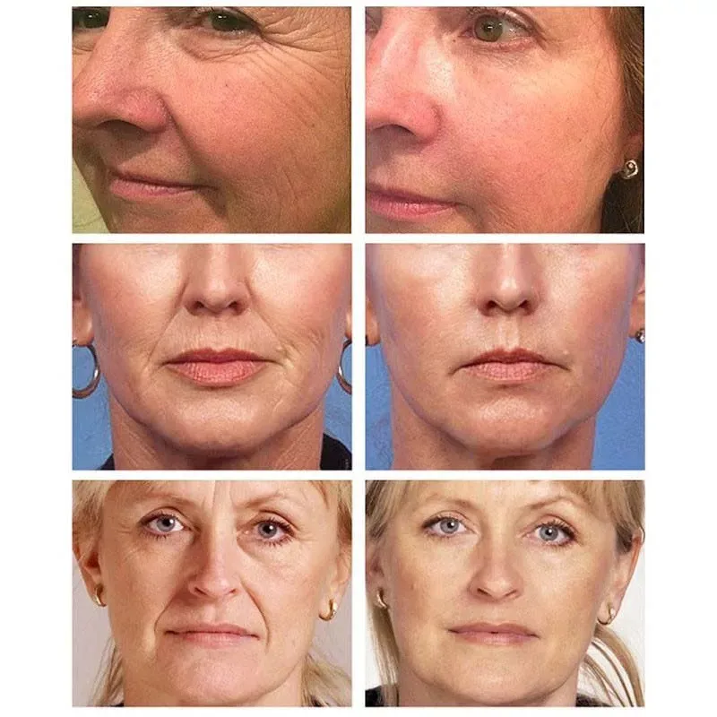 Retinol Kırışıklık temizleme kremi Asansör Sıkılaştırıcı Anti Aging Solmaya Ince Çizgi Yüz Ürün Nemlendirici Beyazlatmak Cilt Güzellik Bakımı Kozmetik - 1