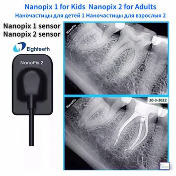 NanoPix1 Nanopix2 Diş röntgeni Sensörü Dijital Diş İntraoral X-ışını CMOS RVG Görüntüleme Sensörü Sistemi Diş Hekimliği için Xray Görüntüleme